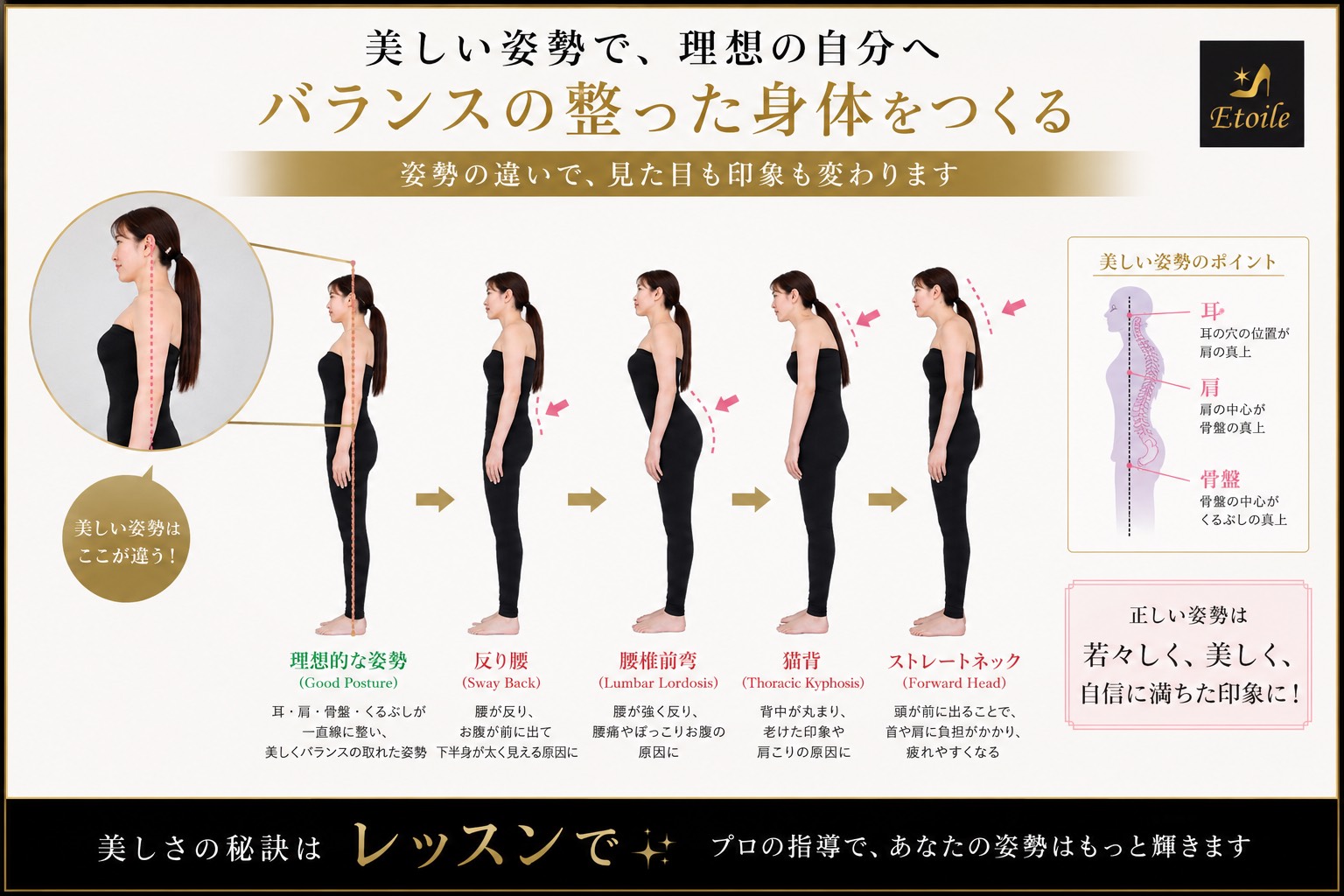 バランスの整った身体をつくる。理想的な姿勢（Good Posture）と、反り腰・腰椎前弯・猫背・ストレートネックの比較図。美しい姿勢のポイントは、耳・肩・骨盤が一直線に整っていること